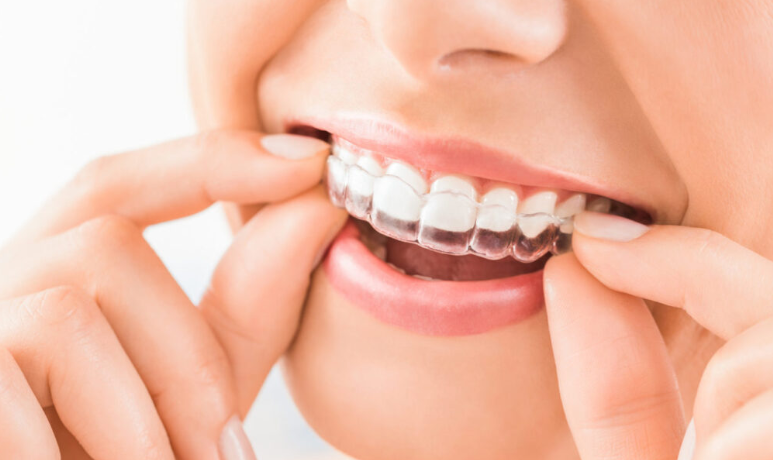 Tollgate Orthodontics: Comprehensive Care for Straighter, Healthier Teeth